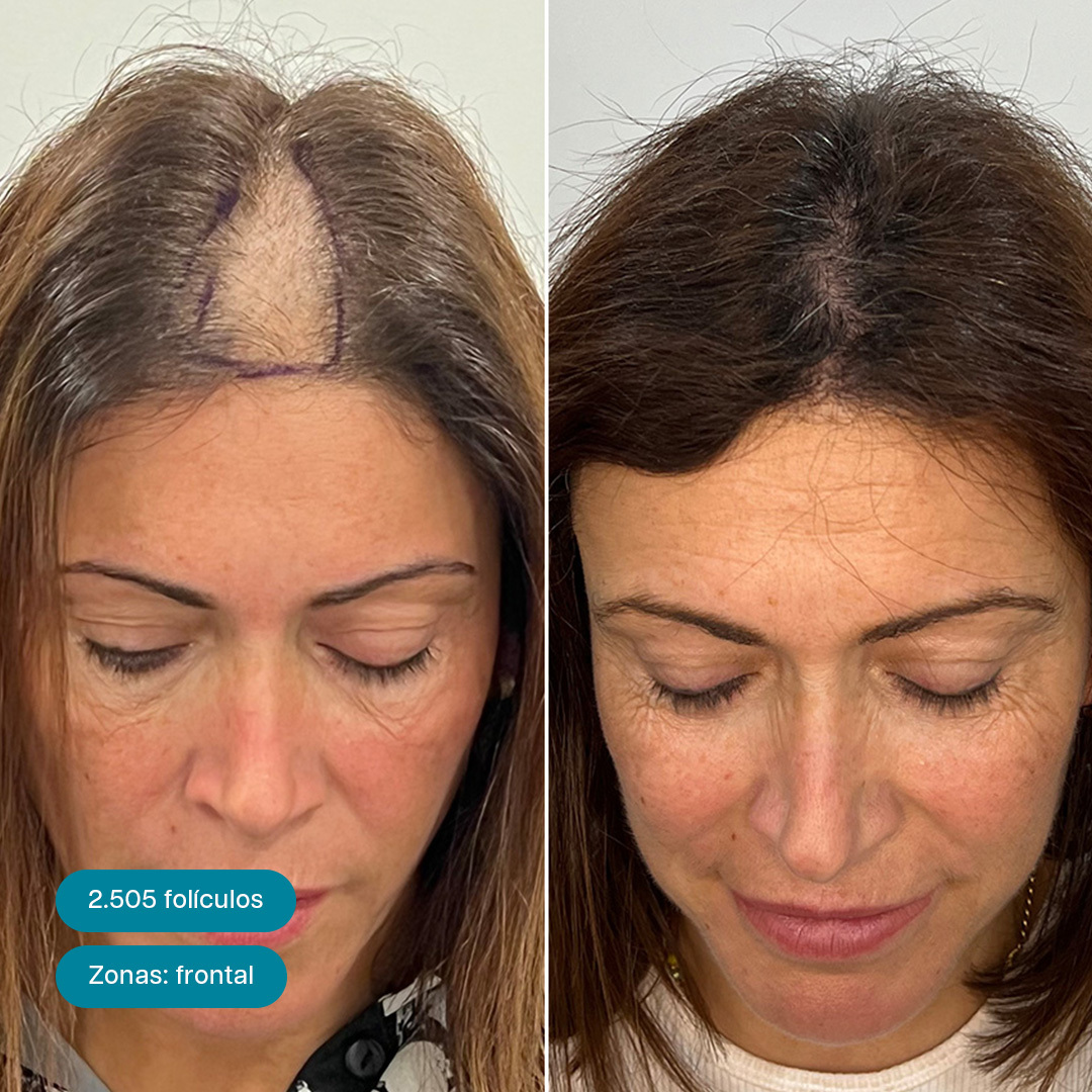 Antes e Depois 2